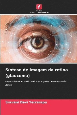 Sntese de imagem da retina (glaucoma) 1
