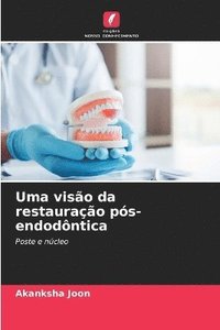 bokomslag Uma viso da restaurao ps-endodntica