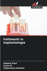 bokomslag Fallimenti in implantologia