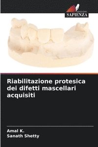 bokomslag Riabilitazione protesica dei difetti mascellari acquisiti