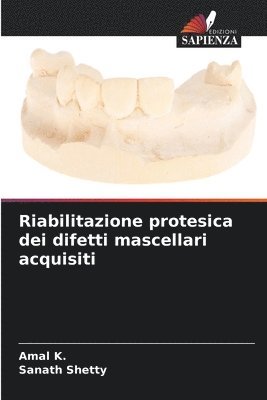 Riabilitazione protesica dei difetti mascellari acquisiti 1