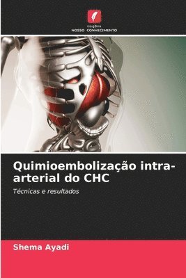 Quimioembolizao intra-arterial do CHC 1