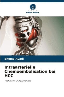 Intraarterielle Chemoembolisation bei HCC 1