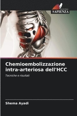 Chemioembolizzazione intra-arteriosa dell'HCC 1
