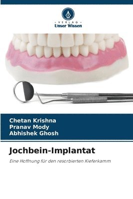 Jochbein-Implantat 1