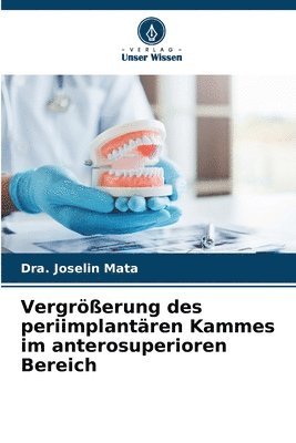 bokomslag Vergrerung des periimplantren Kammes im anterosuperioren Bereich