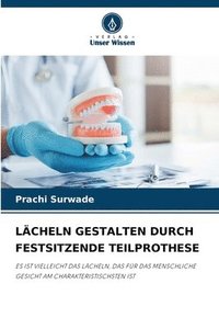 bokomslag Lcheln Gestalten Durch Festsitzende Teilprothese