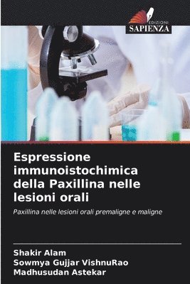 Espressione immunoistochimica della Paxillina nelle lesioni orali 1