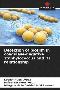 bokomslag Detection of biofilm in coagulase-negative staphylococcus and its relationship