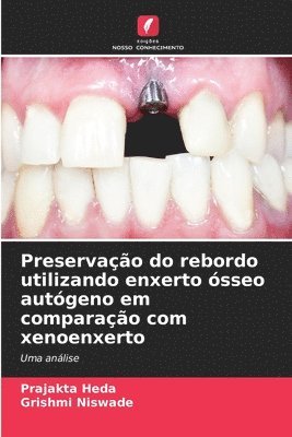 Preservação do rebordo utilizando enxerto ósseo autógeno em comparação com xenoenxerto 1