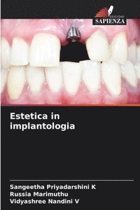 bokomslag Estetica in implantologia