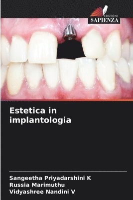 Estetica in implantologia 1