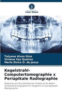 bokomslag Kegelstrahl-Computertomographie x Periapikale Radiographie