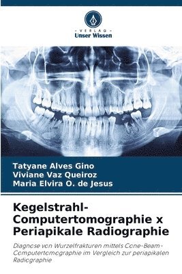 Kegelstrahl-Computertomographie x Periapikale Radiographie 1