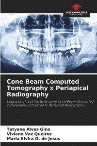 bokomslag Cone Beam Computed Tomography x Periapical Radiography