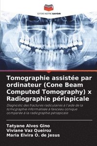 bokomslag Tomographie assiste par ordinateur (Cone Beam Computed Tomography) x Radiographie priapicale