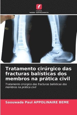 Tratamento cirrgico das fracturas balsticas dos membros na prtica civil 1
