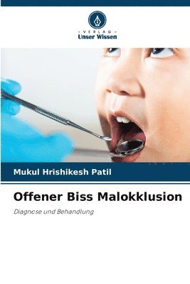 bokomslag Offener Biss Malokklusion