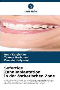 bokomslag Sofortige Zahnimplantation in der sthetischen Zone