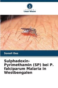 bokomslag Sulphadoxin-Pyrimethamin (SP) bei P. falciparum Malaria in Westbengalen