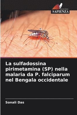 La sulfadossina pirimetamina (SP) nella malaria da P. falciparum nel Bengala occidentale 1