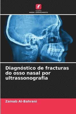 Diagnstico de fracturas do osso nasal por ultrassonografia 1
