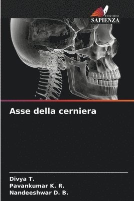 Asse della cerniera 1