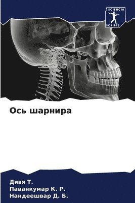 &#1054;&#1089;&#1100; &#1096;&#1072;&#1088;&#1085;&#1080;&#1088;&#1072; 1