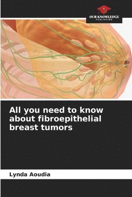 bokomslag All you need to know about fibroepithelial breast tumors