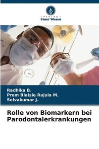 bokomslag Rolle von Biomarkern bei Parodontalerkrankungen