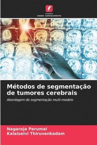 bokomslag Mtodos de segmentao de tumores cerebrais