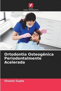 bokomslag Ortodontia Osteognica Periodontalmente Acelerada