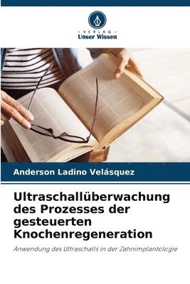 bokomslag Ultraschallberwachung des Prozesses der gesteuerten Knochenregeneration