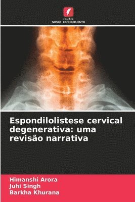 Espondilolistese cervical degenerativa 1