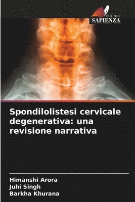 bokomslag Spondilolistesi cervicale degenerativa