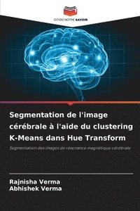 bokomslag Segmentation de l'image crbrale  l'aide du clustering K-Means dans Hue Transform