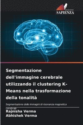 Segmentazione dell'immagine cerebrale utilizzando il clustering K-Means nella trasformazione della tonalit 1