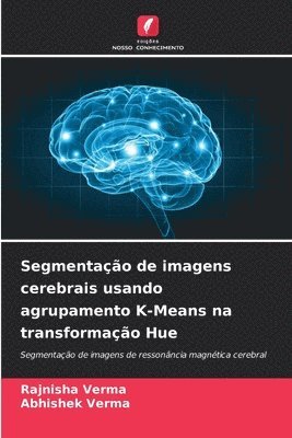 bokomslag Segmentao de imagens cerebrais usando agrupamento K-Means na transformao Hue