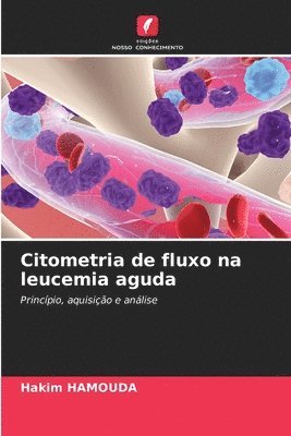 Citometria de fluxo na leucemia aguda 1