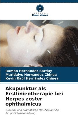 Akupunktur als Erstlinientherapie bei Herpes zoster ophthalmicus 1