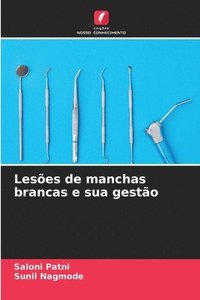 bokomslag Leses de manchas brancas e sua gesto