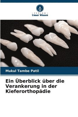 bokomslag Ein berblick ber die Verankerung in der Kieferorthopdie