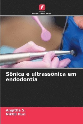 Snica e ultrassnica em endodontia 1