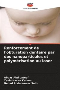 bokomslag Renforcement de l'obturation dentaire par des nanoparticules et polymrisation au laser