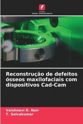 Reconstruo de defeitos sseos maxilofaciais com dispositivos Cad-Cam 1