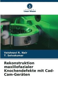 bokomslag Rekonstruktion maxillofazialer Knochendefekte mit Cad-Cam-Gerten