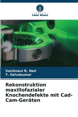 Rekonstruktion maxillofazialer Knochendefekte mit Cad-Cam-Gerten 1