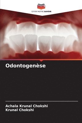 Odontogense 1