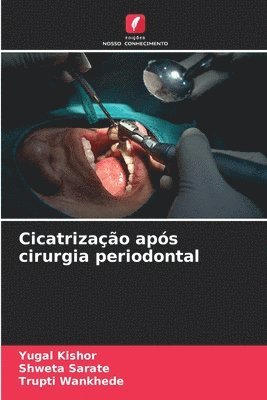 bokomslag Cicatrizao aps cirurgia periodontal