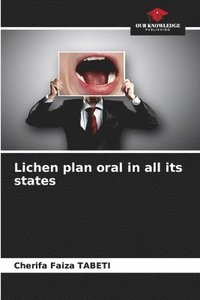 bokomslag Lichen plan oral in all its states